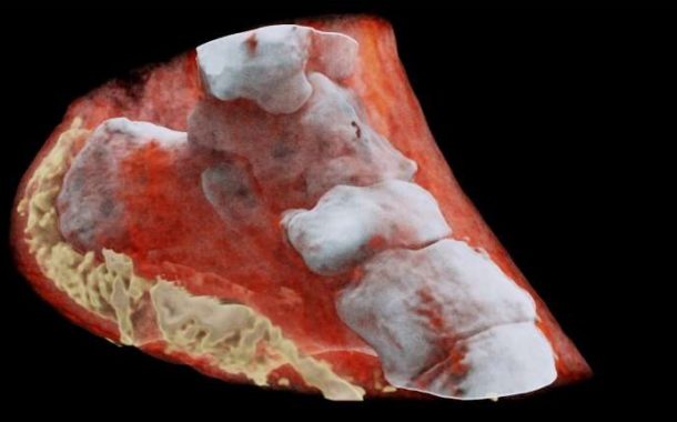 First-ever colour X-ray on a human